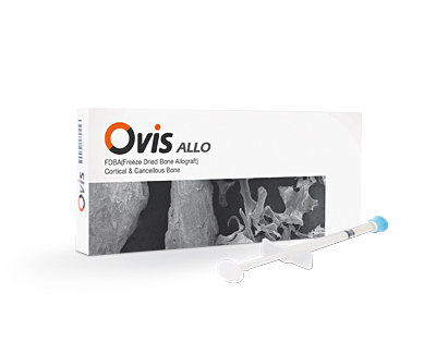 Ovis ALLO 이미지